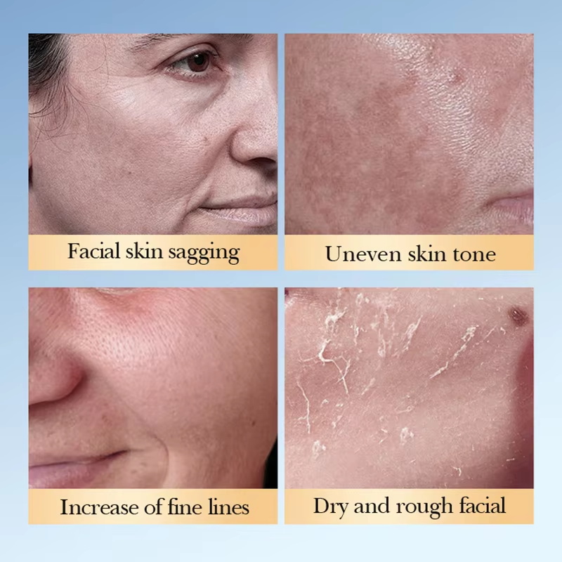 SADOER โทนเนอร์กรดไกลโคลิก เซร - Essence Serum Toner บทวิจารณ์และราคา